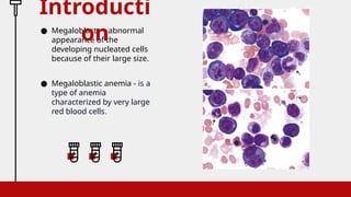 ● Megaloblasts – abnormal
appearance of the
developing nucleated cells
because of their large size.
● Megaloblastic anemia - is a
type of anemia
characterized by very large
red blood cells.
Introducti
on
 