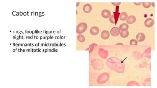 Erythrocyte-Morphology-and-Inclusions 2 (2).pptx