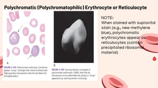 ERYTHROCYTE PRODUCTION & DESCTRUCTION.pdf