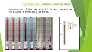 Erythrocyte Sedimentation Rate
Measurement of the rate at which the erythrocytes settle from
the plasma in anticoagulated blood.
 