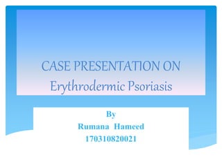 CASE PRESENTATION ON
Erythrodermic Psoriasis
By
Rumana Hameed
170310820021
 
