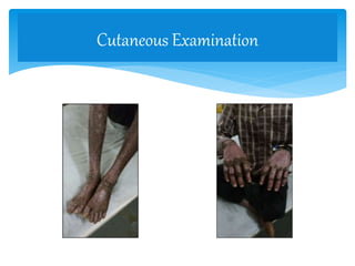 Cutaneous Examination
 
