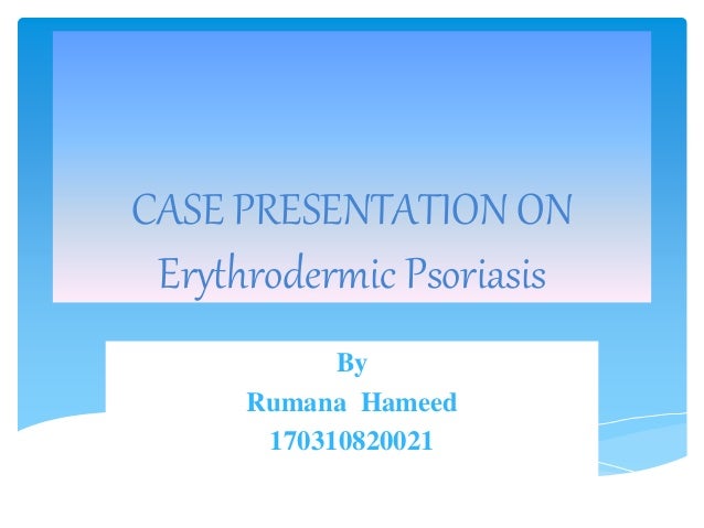 Psoriasis presentation image