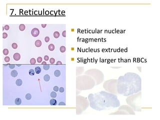 7. Reticulocyte
 Reticular nuclear
fragments
 Nucleus extruded
 Slightly larger than RBCs
 