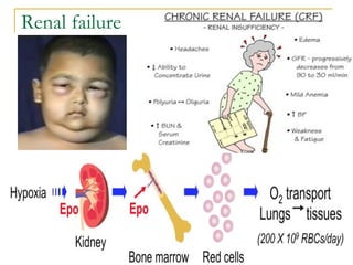 Renal failure
 