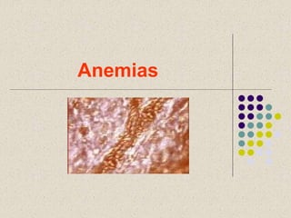 Anemias
 