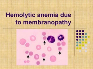 Hemolytic anemia due
to membranopathy
 