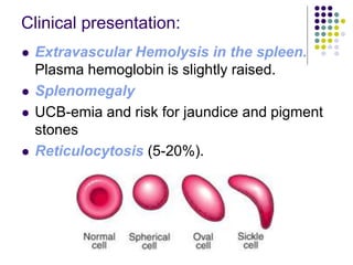 Clinical presentation:
 Extravascular Hemolysis in the spleen.
Plasma hemoglobin is slightly raised.
 Splenomegaly
 UCB-emia and risk for jaundice and pigment
stones
 Reticulocytosis (5-20%).
 