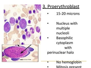 3. Proerythroblast
• 15-20 microns
• Nucleus with
multiple
nucleoli
• Basophilic
cytoplasm
with
perinuclear halo
• No hemoglobin
 