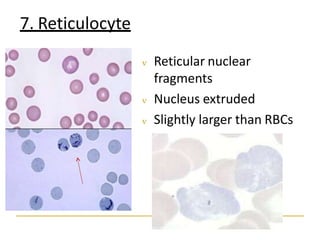 7. Reticulocyte
 Reticular nuclear
fragments
 Nucleus extruded
 Slightly larger than RBCs
 