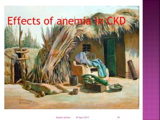 29 April 2017Nabieh Alhilali 16
Effects of anemia in CKD
 