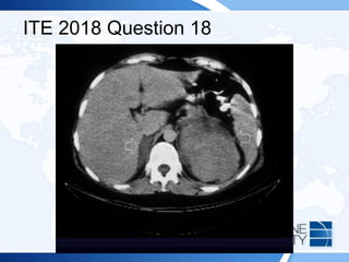 ITE 2018 Question 18
 