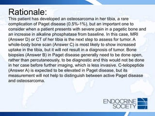 Rationale:
This patient has developed an osteosarcoma in her tibia, a rare
complication of Paget disease (0.5%-1%), but an important one to
consider when a patient presents with severe pain in a pagetic bone and
an increase in alkaline phosphatase from baseline. In this case, MRI
(Answer D) or CT of her tibia is the next step to assess for tumor. A
whole-body bone scan (Answer C) is most likely to show increased
uptake in the tibia, but it will not result in a diagnosis of tumor. Bone
biopsies (Answer B) in Paget disease generally need to be done open,
rather than percutaneously, to be diagnostic and this would not be done
in her case before further imaging, which is less invasive. C-telopeptide
(Answer A) is expected to be elevated in Paget disease, but its
measurement will not help to distinguish between active Paget disease
and osteosarcoma.
 