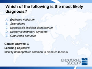Which of the following is the most likely
diagnosis?
A. Erythema nodosum
B. Scleredema
C. Necrobiosis lipoidica diabeticorum
D. Necrolytic migratory erythema
E. Granuloma annulare
Correct Answer: C
Learning objective:
Identify dermopathies common to diabetes mellitus.
 