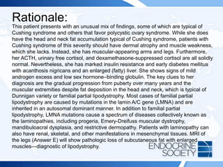 Rationale:
This patient presents with an unusual mix of findings, some of which are typical of
Cushing syndrome and others that favor polycystic ovary syndrome. While she does
have the head and neck fat accumulation typical of Cushing syndrome, patients with
Cushing syndrome of this severity should have dermal atrophy and muscle weakness,
which she lacks. Instead, she has muscular-appearing arms and legs. Furthermore,
her ACTH, urinary free cortisol, and dexamethasone-suppressed cortisol are all solidly
normal. Nevertheless, she has marked insulin resistance and early diabetes mellitus
with acanthosis nigricans and an enlarged (fatty) liver. She shows signs of mild
androgen excess and low sex hormone–binding globulin. The key clues to her
diagnosis are the gradual progression from puberty over many years and the
muscular extremities despite fat deposition in the head and neck, which is typical of
Dunnigan variety or familial partial lipodystrophy. Most cases of familial partial
lipodystrophy are caused by mutations in the lamin A/C gene (LMNA) and are
inherited in an autosomal dominant manner. In addition to familial partial
lipodystrophy, LMNA mutations cause a spectrum of diseases collectively known as
the laminopathies, including progeria, Emery-Dreifuss muscular dystrophy,
mandibuloacral dysplasia, and restrictive dermopathy. Patients with laminopathy can
also have renal, skeletal, and other manifestations in mesenchymal tissues. MRI of
the legs (Answer E) will show pathologic loss of subcutaneous fat with enlarged
muscles—diagnostic of lipodystrophy.
 