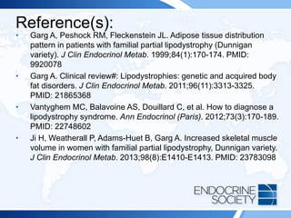 Reference(s):
• Garg A, Peshock RM, Fleckenstein JL. Adipose tissue distribution
pattern in patients with familial partial lipodystrophy (Dunnigan
variety). J Clin Endocrinol Metab. 1999;84(1):170-174. PMID:
9920078
• Garg A. Clinical review#: Lipodystrophies: genetic and acquired body
fat disorders. J Clin Endocrinol Metab. 2011;96(11):3313-3325.
PMID: 21865368
• Vantyghem MC, Balavoine AS, Douillard C, et al. How to diagnose a
lipodystrophy syndrome. Ann Endocrinol (Paris). 2012;73(3):170-189.
PMID: 22748602
• Ji H, Weatherall P, Adams-Huet B, Garg A. Increased skeletal muscle
volume in women with familial partial lipodystrophy, Dunnigan variety.
J Clin Endocrinol Metab. 2013;98(8):E1410-E1413. PMID: 23783098
 