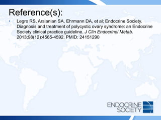 Reference(s):
• Legro RS, Arslanian SA, Ehrmann DA, et al; Endocrine Society.
Diagnosis and treatment of polycystic ovary syndrome: an Endocrine
Society clinical practice guideline. J Clin Endocrinol Metab.
2013;98(12):4565-4592. PMID: 24151290
 