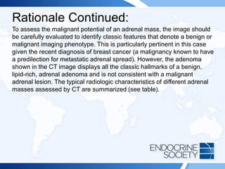 Rationale Continued:
To assess the malignant potential of an adrenal mass, the image should
be carefully evaluated to identify classic features that denote a benign or
malignant imaging phenotype. This is particularly pertinent in this case
given the recent diagnosis of breast cancer (a malignancy known to have
a predilection for metastatic adrenal spread). However, the adenoma
shown in the CT image displays all the classic hallmarks of a benign,
lipid-rich, adrenal adenoma and is not consistent with a malignant
adrenal lesion. The typical radiologic characteristics of different adrenal
masses assessed by CT are summarized (see table).
 