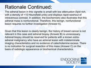 Rationale Continued:
The adrenal lesion in this vignette is small with low attenuation (lipid rich,
with a density of <10 Hounsfield units) and displays rapid washout of
intravenous contrast. In addition, the biochemistry also illustrates that this
adrenal mass is nonfunctional. Therefore, this benign, nonfunctional
lesion requires no further investigation (Answer A).
Given that this lesion is clearly benign, the history of breast cancer is not
relevant in this case and adrenal biopsy (Answer B) is unnecessary.
Adrenal biopsy should be reserved for patients with a known extra-
adrenal malignancy who have an adrenal lesion with indeterminate
imaging characteristics and no evidence of catecholamine excess. There
is no indication for surgical resection of this mass (Answer C) on the
basis of radiologic appearance or biochemical characteristics.
 