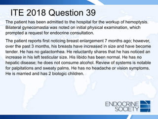 ITE 2018 Question 39
The patient has been admitted to the hospital for the workup of hemoptysis.
Bilateral gynecomastia was noted on initial physical examination, which
prompted a request for endocrine consultation.
The patient reports first noticing breast enlargement 7 months ago; however,
over the past 3 months, his breasts have increased in size and have become
tender. He has no galactorrhea. He reluctantly shares that he has noticed an
increase in his left testicular size. His libido has been normal. He has no
hepatic disease; he does not consume alcohol. Review of systems is notable
for palpitations and sweaty palms. He has no headache or vision symptoms.
He is married and has 2 biologic children.
 