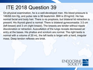 ITE 2018 Question 39
On physical examination, he is a well-developed man. His blood pressure is
148/68 mm Hg, and pulse rate is 96 beats/min. BMI is 29 kg/m2. He has
normal facial and body hair. There is no proptosis, but bilateral lid retraction is
present. His thyroid gland is normal. There is bilateral gynecomastia: 3.5 cm
(left breast) and 3 cm (right breast). The breasts are tender without nipple
discoloration or retraction. Auscultation of the lungs reveals decreased air
entry at the bases. His phallus and scrotum are normal. The right testis is
normal with a volume of 20 mL; the left testis is larger with a hard, irregular
mass. Deep tendon reflexes are brisk.
 
