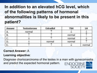 In addition to an elevated hCG level, which
of the following patterns of hormonal
abnormalities is likely to be present in this
patient?
Correct Answer: A
Learning objective:
Diagnose choriocarcinoma of the testes in a man with gynecomastia
and predict the expected hormonal pattern.
 