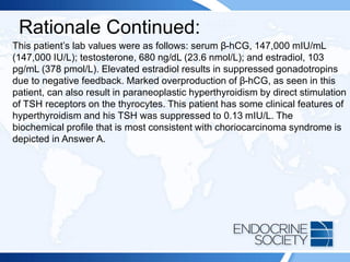 Rationale Continued:
This patient’s lab values were as follows: serum β-hCG, 147,000 mIU/mL
(147,000 IU/L); testosterone, 680 ng/dL (23.6 nmol/L); and estradiol, 103
pg/mL (378 pmol/L). Elevated estradiol results in suppressed gonadotropins
due to negative feedback. Marked overproduction of β-hCG, as seen in this
patient, can also result in paraneoplastic hyperthyroidism by direct stimulation
of TSH receptors on the thyrocytes. This patient has some clinical features of
hyperthyroidism and his TSH was suppressed to 0.13 mIU/L. The
biochemical profile that is most consistent with choriocarcinoma syndrome is
depicted in Answer A.
 