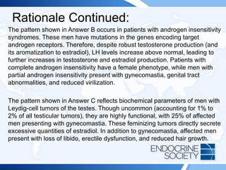 Rationale Continued:
The pattern shown in Answer B occurs in patients with androgen insensitivity
syndromes. These men have mutations in the genes encoding target
androgen receptors. Therefore, despite robust testosterone production (and
its aromatization to estradiol), LH levels increase above normal, leading to
further increases in testosterone and estradiol production. Patients with
complete androgen insensitivity have a female phenotype, while men with
partial androgen insensitivity present with gynecomastia, genital tract
abnormalities, and reduced virilization.
The pattern shown in Answer C reflects biochemical parameters of men with
Leydig-cell tumors of the testes. Though uncommon (accounting for 1% to
2% of all testicular tumors), they are highly functional, with 25% of affected
men presenting with gynecomastia. These feminizing tumors directly secrete
excessive quantities of estradiol. In addition to gynecomastia, affected men
present with loss of libido, erectile dysfunction, and reduced hair growth.
 