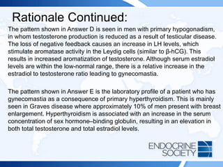 Rationale Continued:
The pattern shown in Answer D is seen in men with primary hypogonadism,
in whom testosterone production is reduced as a result of testicular disease.
The loss of negative feedback causes an increase in LH levels, which
stimulate aromatase activity in the Leydig cells (similar to β-hCG). This
results in increased aromatization of testosterone. Although serum estradiol
levels are within the low-normal range, there is a relative increase in the
estradiol to testosterone ratio leading to gynecomastia.
The pattern shown in Answer E is the laboratory profile of a patient who has
gynecomastia as a consequence of primary hyperthyroidism. This is mainly
seen in Graves disease where approximately 10% of men present with breast
enlargement. Hyperthyroidism is associated with an increase in the serum
concentration of sex hormone–binding globulin, resulting in an elevation in
both total testosterone and total estradiol levels.
 
