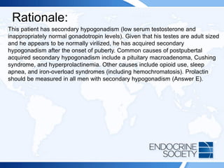 Rationale:
This patient has secondary hypogonadism (low serum testosterone and
inappropriately normal gonadotropin levels). Given that his testes are adult sized
and he appears to be normally virilized, he has acquired secondary
hypogonadism after the onset of puberty. Common causes of postpubertal
acquired secondary hypogonadism include a pituitary macroadenoma, Cushing
syndrome, and hyperprolactinemia. Other causes include opioid use, sleep
apnea, and iron-overload syndromes (including hemochromatosis). Prolactin
should be measured in all men with secondary hypogonadism (Answer E).
 