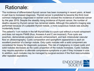 Rationale:
The incidence of differentiated thyroid cancer has been increasing in recent years, at least
in part due to increased diagnosis. Thyroid cancer is predicted to become the third most
common malignancy diagnosed in women and to exceed the incidence of colorectal cancer
by the year 2019. Despite the steadily rising incidence of thyroid cancer, the number of
deaths caused by thyroid cancer has remained stable. Although this patient’s imaging was
performed because of a palpable thyroid nodule, a more suspicious nodule was actually
incidentally found.
The patient’s 1-cm nodule in the left thyroid lobe is a pure cyst without a mural component
and does not require FNAB (thus, Answers A and C are incorrect). Pure cysts are
anechoic, demonstrate posterior acoustic enhancement, and lack intranodular vascular
flow on ultrasonography. Cystic composition and spongiform appearance is each an
excellent predictor of a benign nodule. Only cystic nodules with a solid component are
considered for biopsy for diagnostic purposes. The risk of malignancy in mixed cystic and
solid nodules decreases as the cystic proportion of the nodule increases. Cystic nodules
may require aspiration to alleviate compressive symptoms or pain if they increase in size.
In addition, such nodules may be managed by surgical excision if the fluid reaccumulates
after repeated aspirations.
 