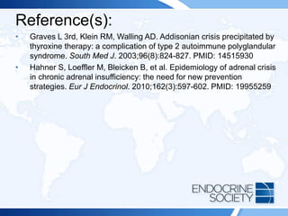 Reference(s):
• Graves L 3rd, Klein RM, Walling AD. Addisonian crisis precipitated by
thyroxine therapy: a complication of type 2 autoimmune polyglandular
syndrome. South Med J. 2003;96(8):824-827. PMID: 14515930
• Hahner S, Loeffler M, Bleicken B, et al. Epidemiology of adrenal crisis
in chronic adrenal insufficiency: the need for new prevention
strategies. Eur J Endocrinol. 2010;162(3):597-602. PMID: 19955259
 