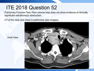 ITE 2018 Question 52
Pulmonary Function Test: Flow volume loop does not show evidence of clinically
significant extrathoracic obstruction.
CT of his neck and chest is performed (see images).
Axial View
 
