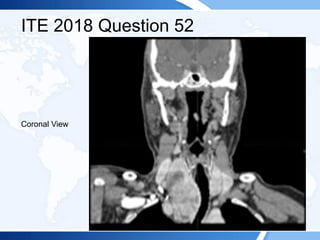 ITE 2018 Question 52
Coronal View
 
