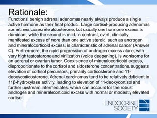 Rationale:
Functional benign adrenal adenomas nearly always produce a single
active hormone as their final product. Large cortisol-producing adenomas
sometimes cosecrete aldosterone, but usually one hormone excess is
dominant, while the second is mild. In contrast, overt, clinically
manifested excess of more than one active steroid, such as androgen
and mineralocorticoid excess, is characteristic of adrenal cancer (Answer
C). Furthermore, the rapid progression of androgen excess alone, with
very high testosterone and virilization (voice deepening), is worrisome for
an adrenal or ovarian tumor. Coexistence of mineralocorticoid excess,
disproportionate to the cortisol and aldosterone concentrations, suggests
elevation of cortisol precursors, primarily corticosterone and 11-
deoxycorticosterone. Adrenal carcinomas tend to be relatively deficient in
11β-hydroxylase activity, leading to elevation of 11-deoxycortisol and
further upstream intermediates, which can account for the robust
androgen and mineralocorticoid excess with normal or modestly elevated
cortisol.
 
