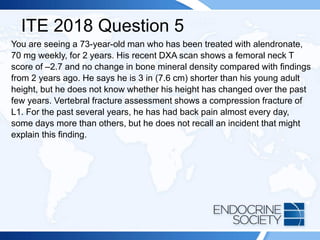 ITE 2018 Question 5
You are seeing a 73-year-old man who has been treated with alendronate,
70 mg weekly, for 2 years. His recent DXA scan shows a femoral neck T
score of –2.7 and no change in bone mineral density compared with findings
from 2 years ago. He says he is 3 in (7.6 cm) shorter than his young adult
height, but he does not know whether his height has changed over the past
few years. Vertebral fracture assessment shows a compression fracture of
L1. For the past several years, he has had back pain almost every day,
some days more than others, but he does not recall an incident that might
explain this finding.
 