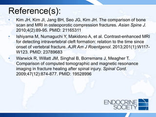 Reference(s):
• Kim JH, Kim JI, Jang BH, Seo JG, Kim JH. The comparison of bone
scan and MRI in osteoporotic compression fractures. Asian Spine J.
2010;4(2):89-95. PMID: 21165311
• Ishiyama M, Numaguchi Y, Makidono A, et al. Contrast-enhanced MRI
for detecting intravertebral cleft formation: relation to the time since
onset of vertebral fracture. AJR Am J Roentgenol. 2013;201(1):W117-
W123. PMID: 23789683
• Warwick R, Willatt JM, Singhal B, Borremans J, Meagher T.
Comparison of computed tomographic and magnetic resonance
imaging in fracture healing after spinal injury. Spinal Cord.
2009;47(12):874-877. PMID: 19528996
 