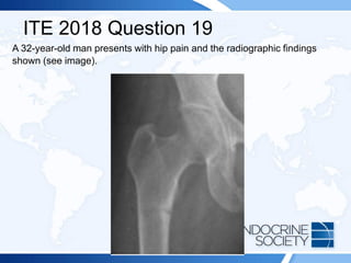 ITE 2018 Question 19
A 32-year-old man presents with hip pain and the radiographic findings
shown (see image).
 