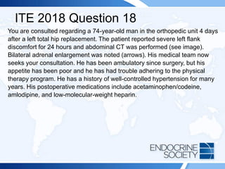 ITE 2018 Question 18
You are consulted regarding a 74-year-old man in the orthopedic unit 4 days
after a left total hip replacement. The patient reported severe left flank
discomfort for 24 hours and abdominal CT was performed (see image).
Bilateral adrenal enlargement was noted (arrows). His medical team now
seeks your consultation. He has been ambulatory since surgery, but his
appetite has been poor and he has had trouble adhering to the physical
therapy program. He has a history of well-controlled hypertension for many
years. His postoperative medications include acetaminophen/codeine,
amlodipine, and low-molecular-weight heparin.
 