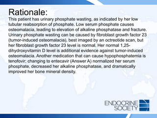 Rationale:
This patient has urinary phosphate wasting, as indicated by her low
tubular reabsorption of phosphate. Low serum phosphate causes
osteomalacia, leading to elevation of alkaline phosphatase and fracture.
Urinary phosphate wasting can be caused by fibroblast growth factor 23
(tumor-induced osteomalacia), best imaged by an octreotide scan, but
her fibroblast growth factor 23 level is normal. Her normal 1,25-
dihydroxyvitamin D level is additional evidence against tumor-induced
osteomalacia. Another medication that can cause hypophosphatemia is
tenofovir; changing to entecavir (Answer A) normalized her serum
phosphate, decreased her alkaline phosphatase, and dramatically
improved her bone mineral density.
 