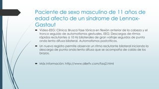 Paciente de sexo masculino de 11 años de
edad afecto de un síndrome de Lennox-
Gastaut
 Video-EEG: Clínica; Brusca fase tónica en flexión anterior de la cabeza y el
tronco seguido de automatismos gestuales. EEG; Descargas de ritmos
rápidos reclutantes a 10 Hz bilaterales de gran voltaje seguidos de punta
onda lenta difusa bilateral. Automatismos postcriticos.
 Un nuevo registro permite observar un ritmo reclutante bilateral iniciando la
descarga de punta onda lenta difusa que se acompaña de caída de los
brazos.
 Más información: http://www.ollerfv.com/faq2.html
 