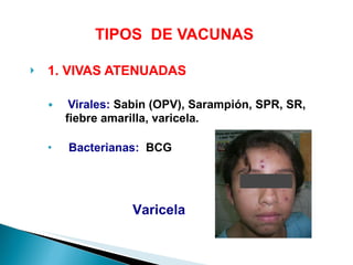 TIPOS  DE VACUNAS  1. VIVAS ATENUADAS Virales:  Sabin (OPV), Sarampión, SPR, SR, fiebre amarilla, varicela. Bacterianas:   BCG Varicela  