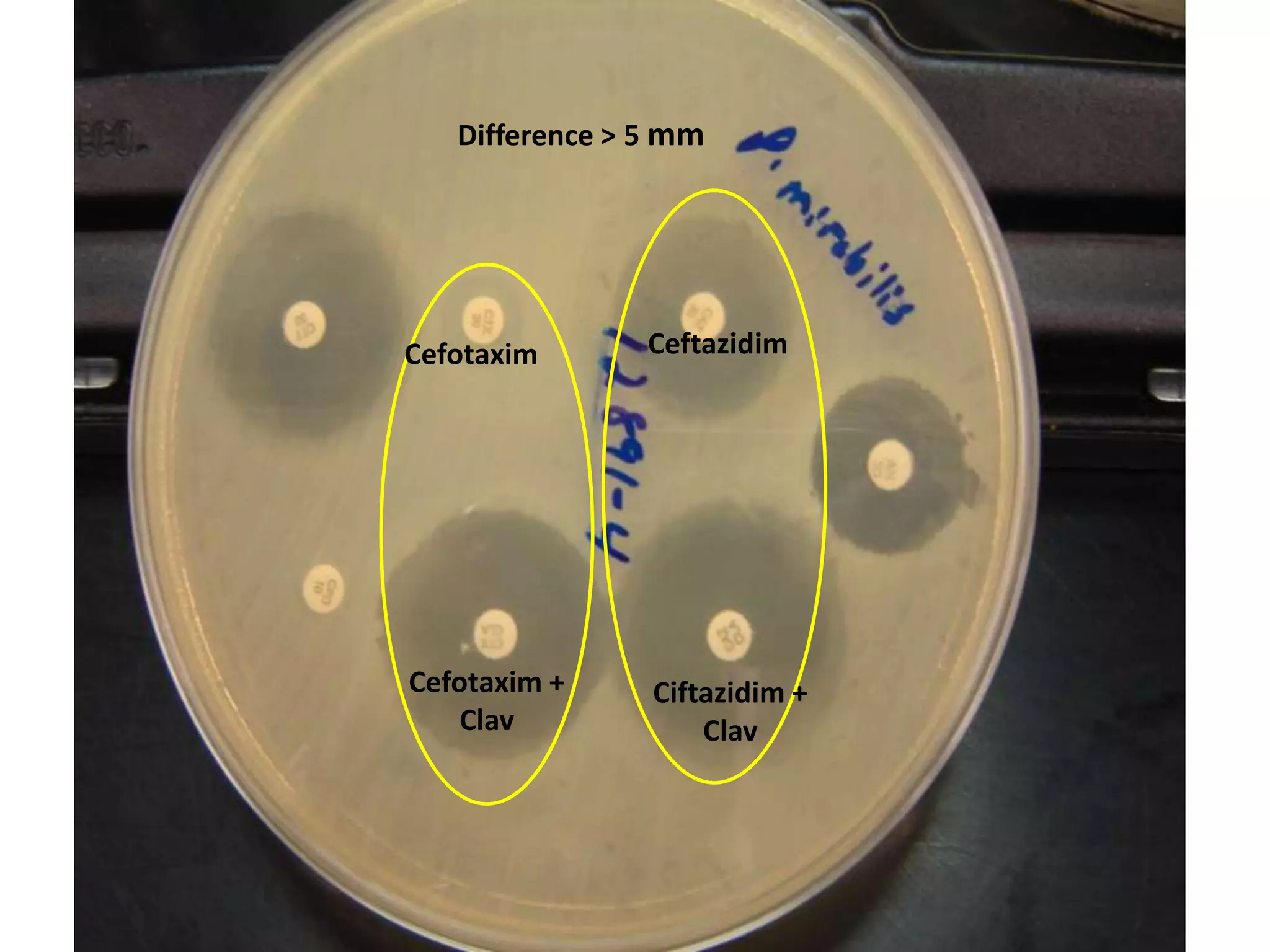Difference > 5 mm

Cefotaxim

Ceftazidim

Cefotaxim +
Clav

Ciftazidim +
Clav

 