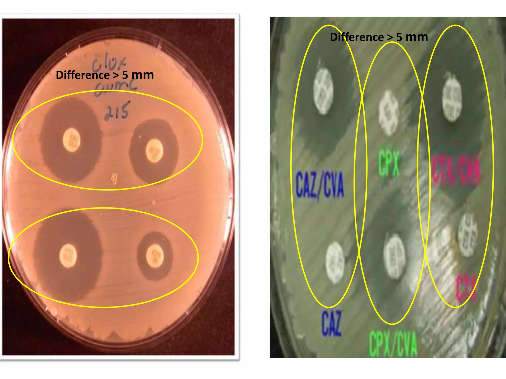Difference > 5 mm
Difference > 5 mm

 