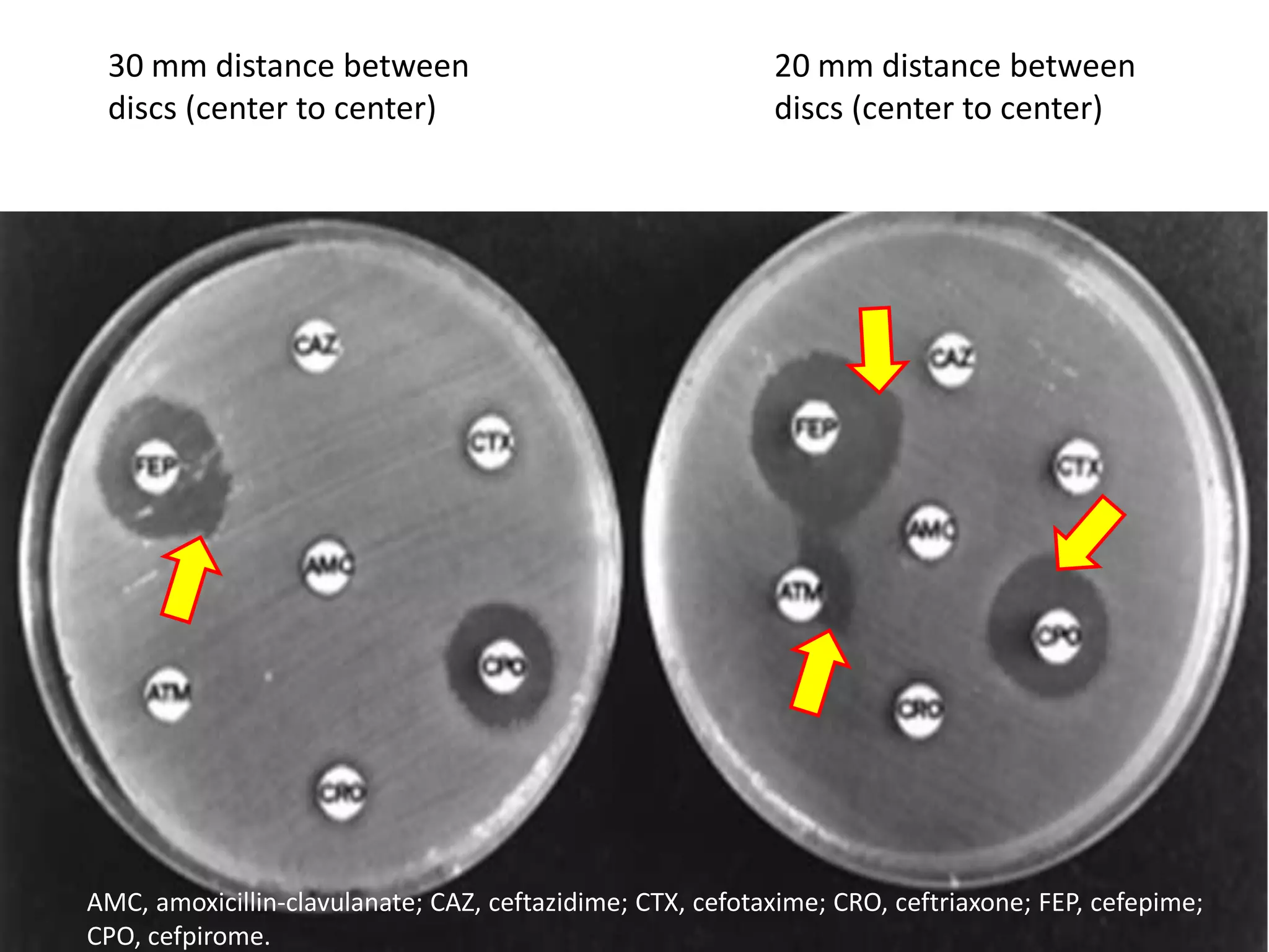 30 mm distance between
discs (center to center)

20 mm distance between
discs (center to center)

AMC, amoxicillin-clavulanate; CAZ, ceftazidime; CTX, cefotaxime; CRO, ceftriaxone; FEP, cefepime;
CPO, cefpirome.

 