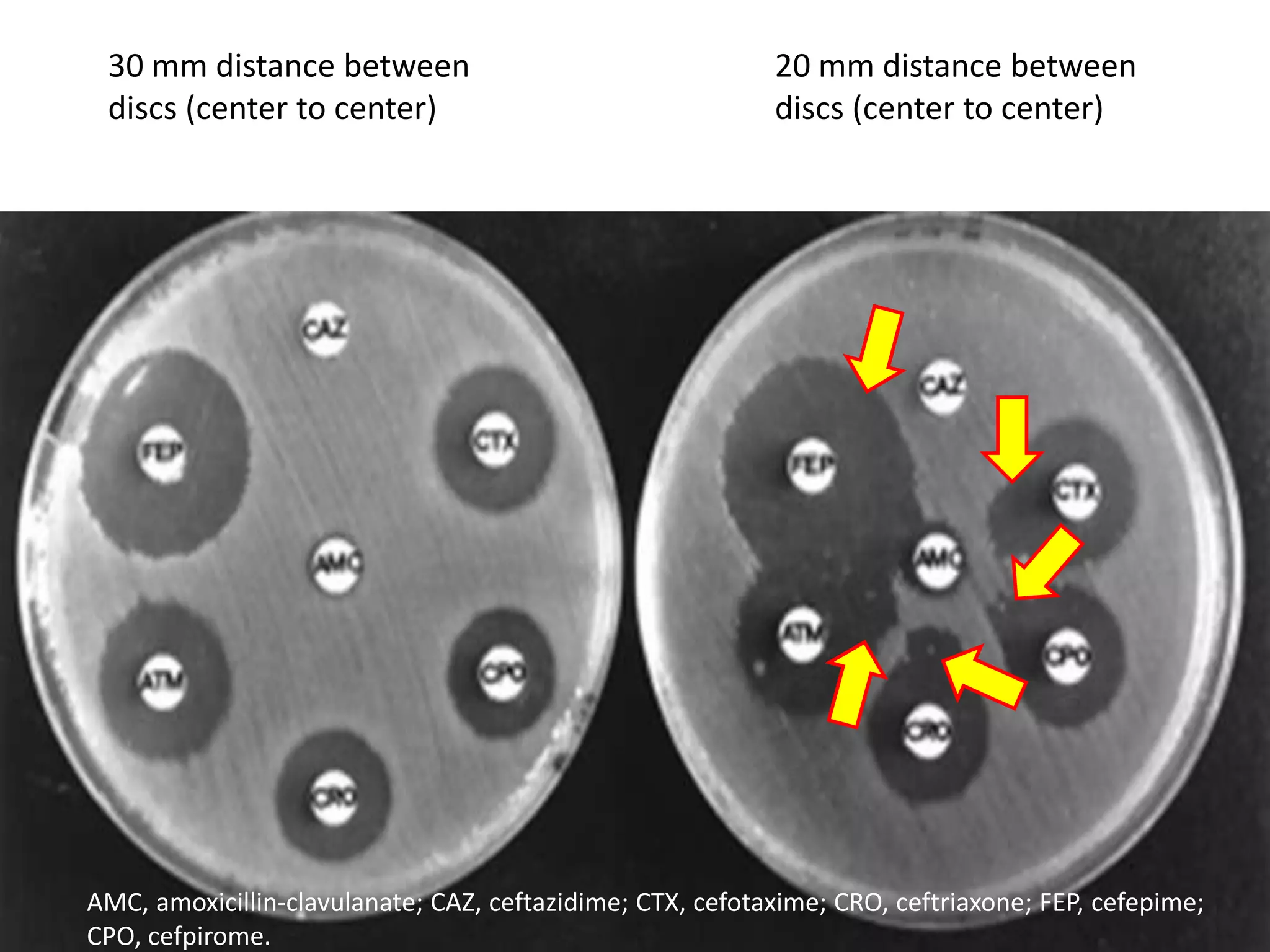 30 mm distance between
discs (center to center)

20 mm distance between
discs (center to center)

AMC, amoxicillin-clavulanate; CAZ, ceftazidime; CTX, cefotaxime; CRO, ceftriaxone; FEP, cefepime;
CPO, cefpirome.

 