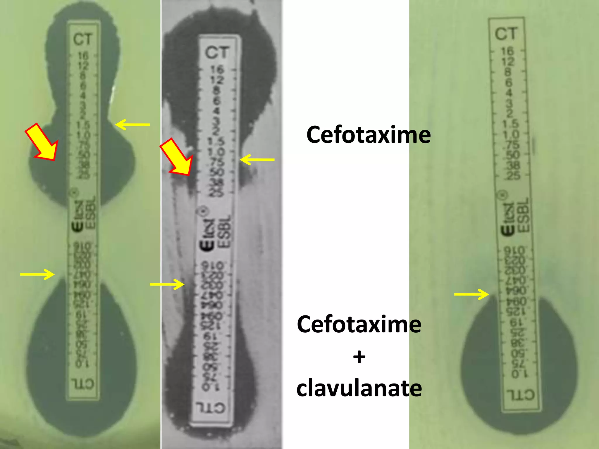 Cefotaxime

Cefotaxime
+
clavulanate

 