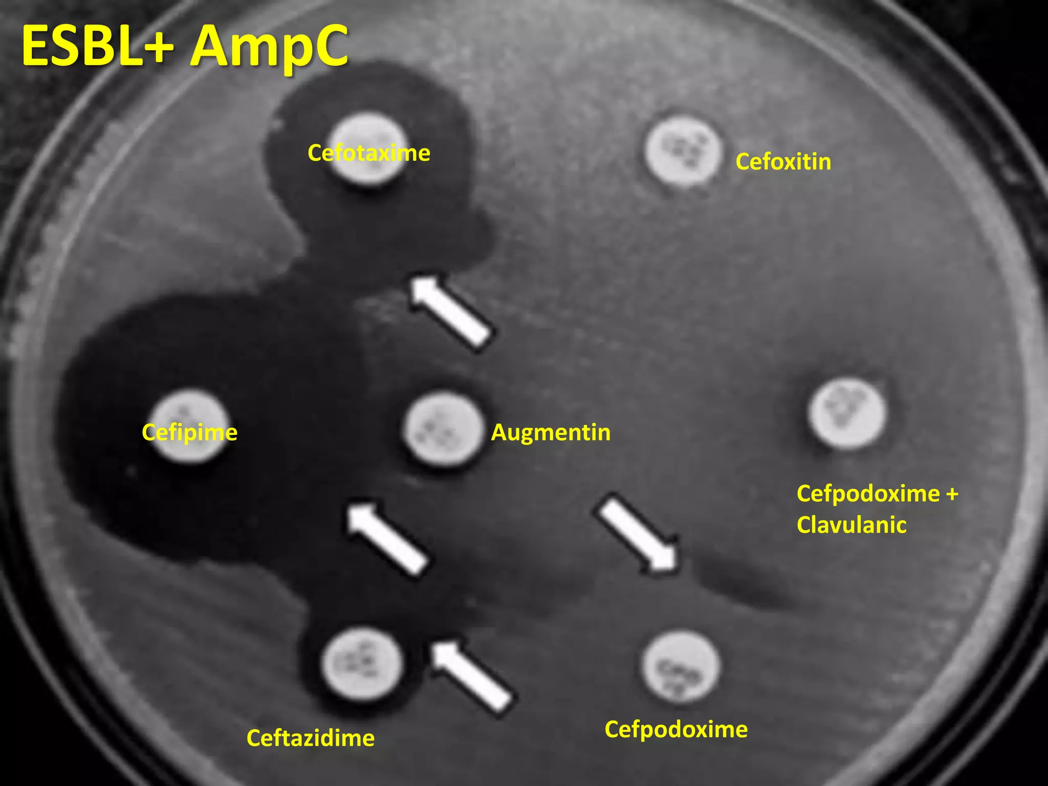 ESBL+ AmpC
Cefotaxime

Cefipime

Cefoxitin

Augmentin
Cefpodoxime +
Clavulanic

Ceftazidime

Cefpodoxime

 