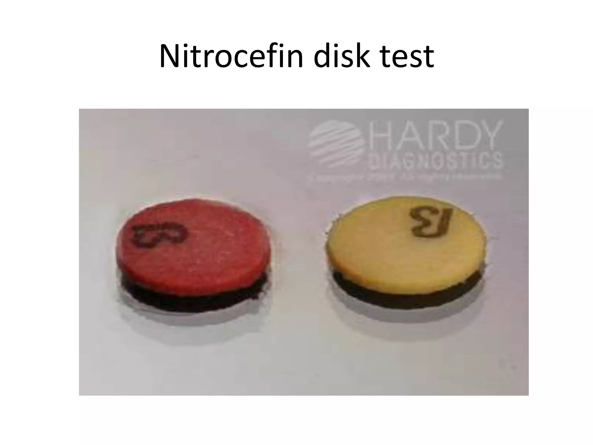 Nitrocefin disk test
 