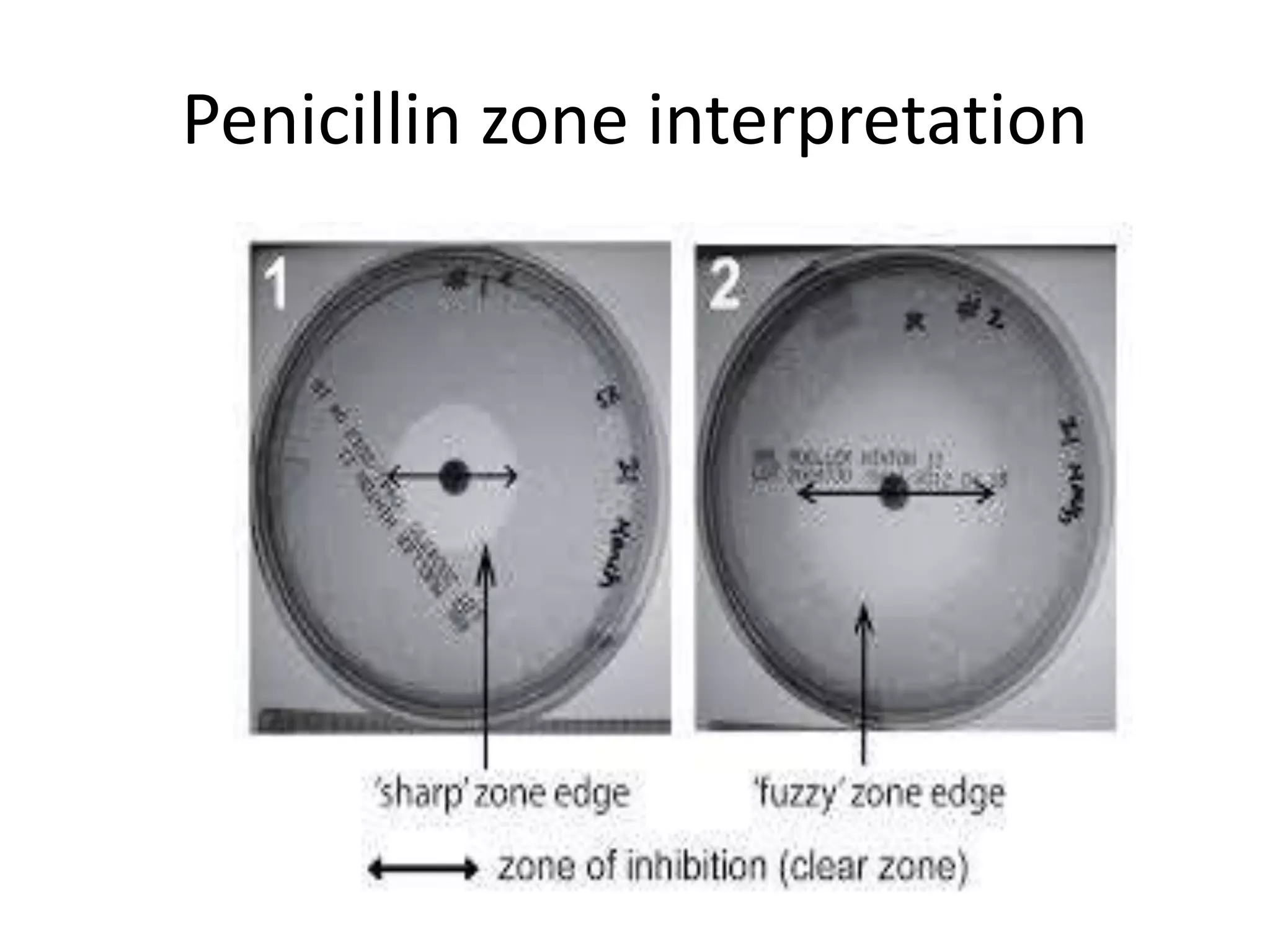 Penicillin zone interpretation
 